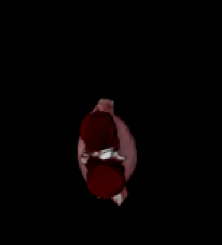 Another angle of the patched scan in Cinema 4D.